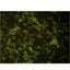 OMAX 40x-2500x w/ Built-In 3.0mp Digital Compound Microscope