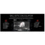 ATN Mars 4 4-40x 640x480 Thermal Rifle Scope - Jacobs Digital